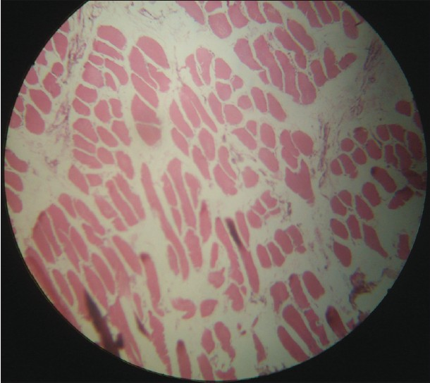 Muscle biopsy : normal study ( H and E, ×10)