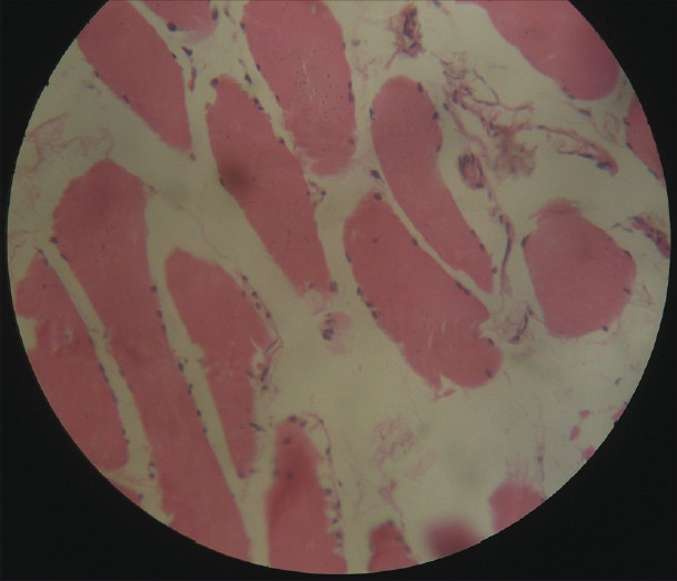 Muscle biopsy : normal study (H and E, ×40)