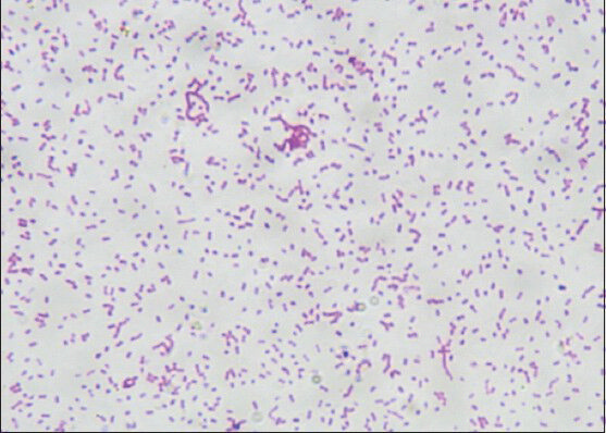 Gram-stained smears photomicrograph showing Pasteurella haemolytica