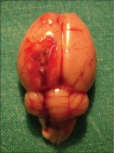 Resected whole brain specimen after perfusion procedures and decapitation