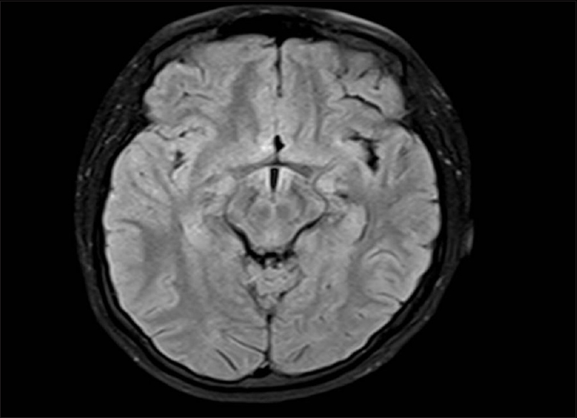 Magnetic resonance imaging fluid-attenuated inversion recovery axial image of patient no. 12 showing normal brain parenchyma