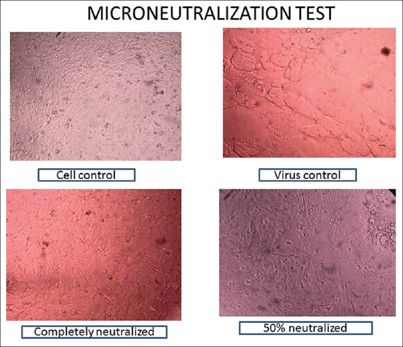 Microneutralization test to see the difference between the positive and the negative