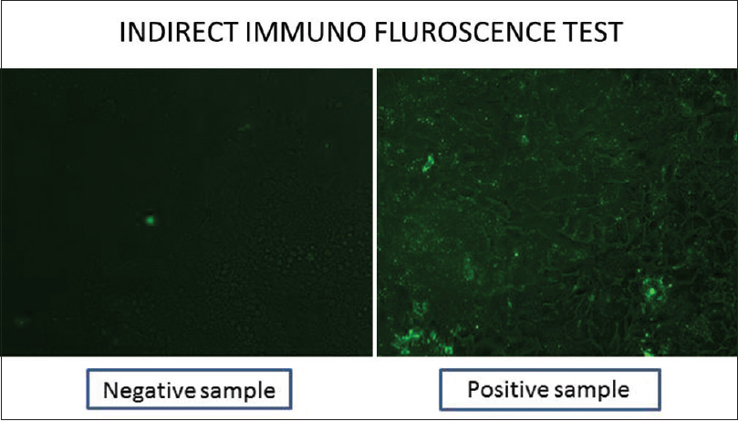 Immunofluorescence test