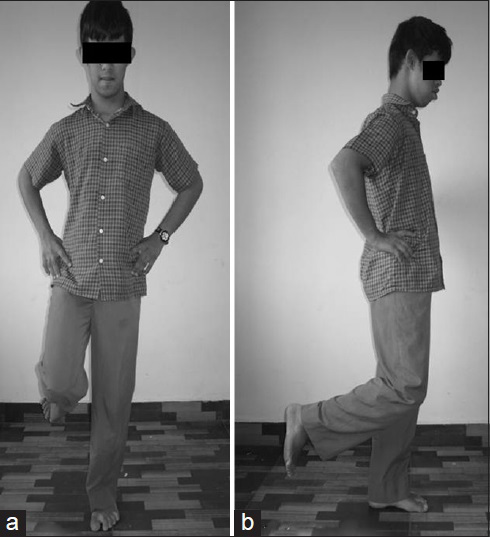 A child with down syndrome performing the timed static standing balance test by standing over the flat surface (a) AP view (b) Lateral view