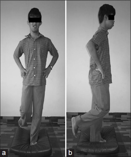 A child with down syndrome performing the timed dynamic standing balance test by standing over the foam surface (a) AP view (b) Lateral view