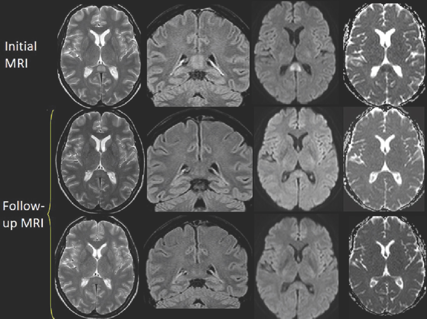 Follow-up brain images