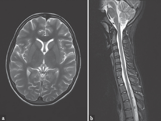 (a) Magnetic resonance imaging – T2 axial brain image (b) magnetic resonance imaging – T2 spine sagittal