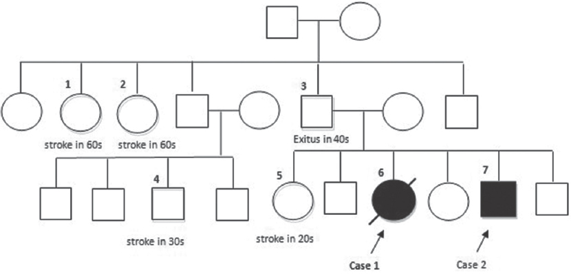 Turkish cerebral autosomal dominant arteriopathy with subcortical infarcts and leukoencephalopathy pedigree