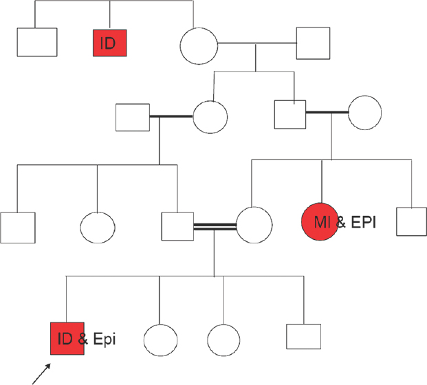 History of intellectual disability, epilepsy, and mental illness