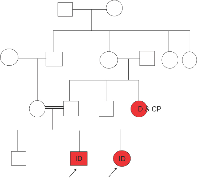 History of intellectual disability and cerebral palsy