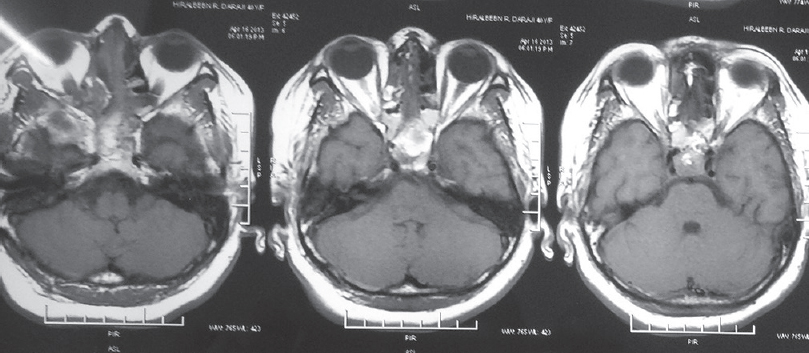 T1 postoperative images