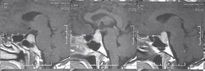 Sagittal image of TI-weighted magnetic resonance imaging