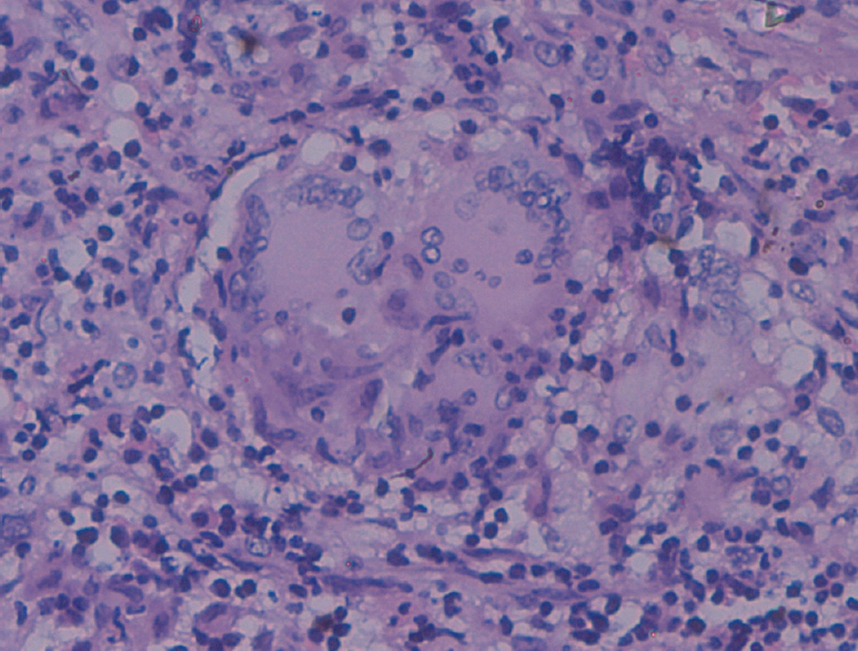 Enlarge histopathology image