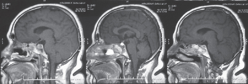 Postoperative sagittal images