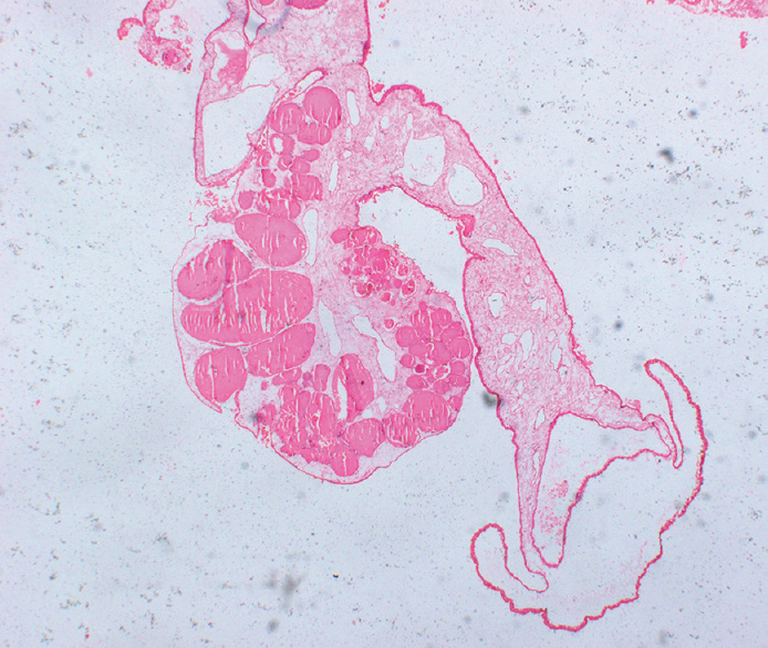 Larva with evagination of the neck and hydropic degeneration of the scolices (H and E, ×40)