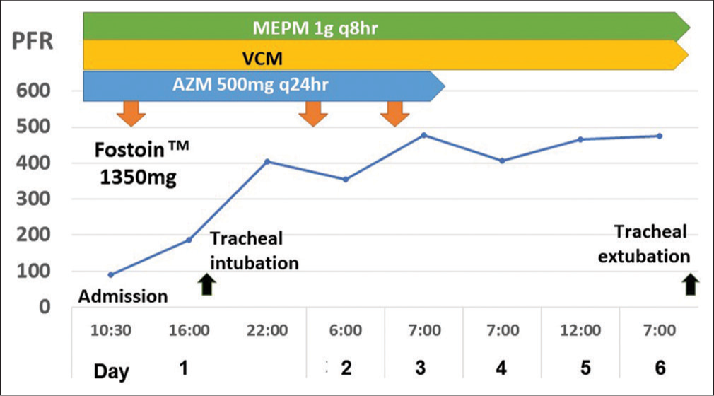 Clinical course showing gradual neurogenic pulmonary edema due to ARDS after general convulsion. The respiratory status revealed gradual improvement from aspects of his PaO2/FiO2 ratio (PFR) during consecutive 6 days after an initiation of medical treatments. X-axis represents time in days after initial treatment with mechanical ventilatory managements, Y-axis represents respiratory oxygenized parameter using PFR in mmHg. Upper three lines represent intravenously administered antibiotics for treatment of coexisting bacterial pneumonia. AZM: Azithromycin, FiO2: Fraction of inspiratory oxygen, MEPM: Meropenem hydrate, PaO2: Partial oxygen pressure (mmHg), PFR: PaO2/FiO2 ratio, VCM: Vancomycin.