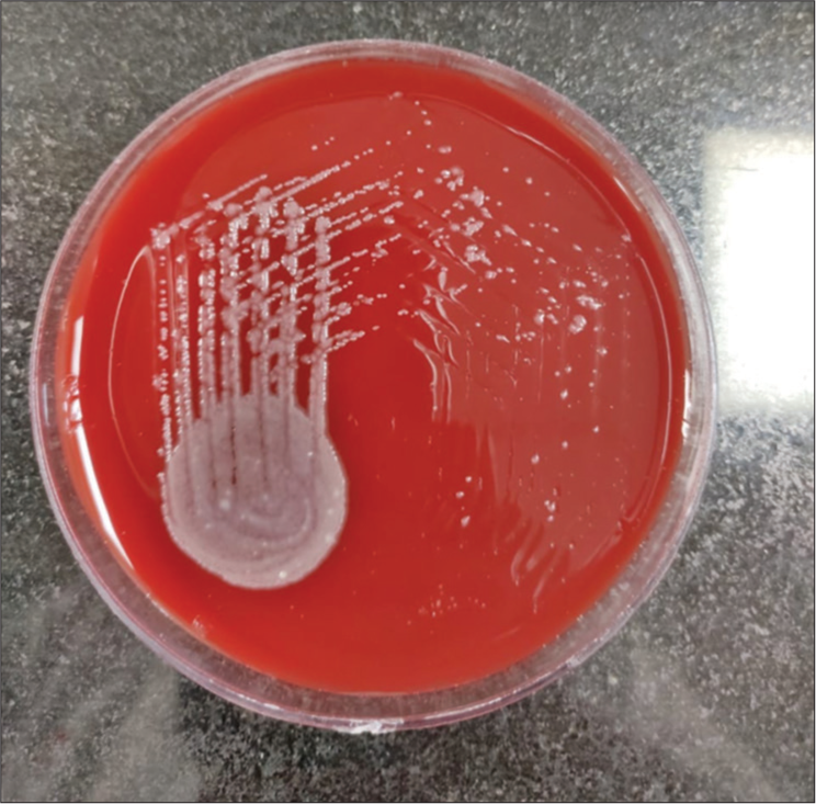 Blood agar: Smooth creamy white colonies on ashdown medium for selective isolation.