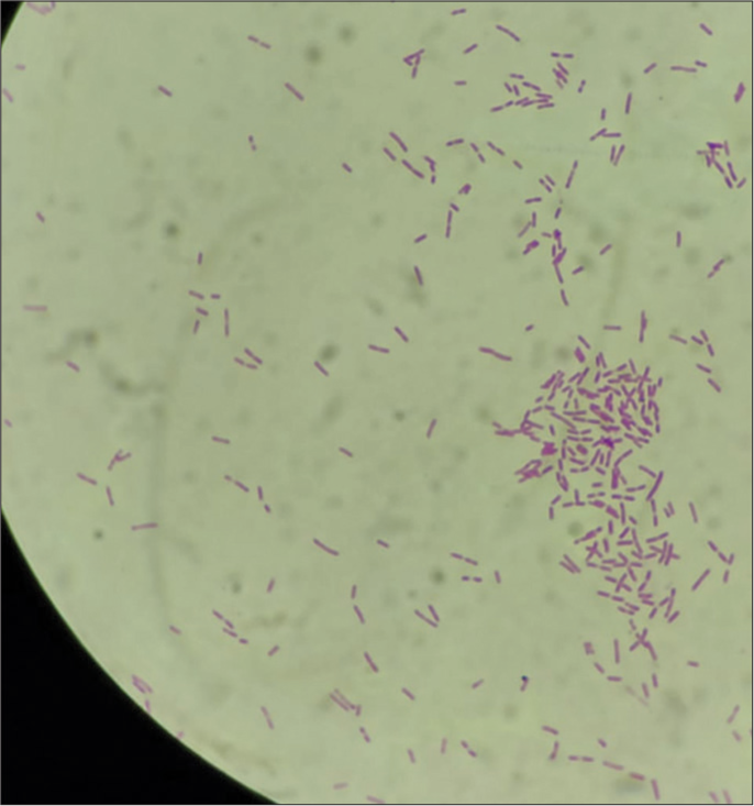 Synovial fluid analysis: Gramnegative motile bacilli bipolar rod-shaped bacterium.