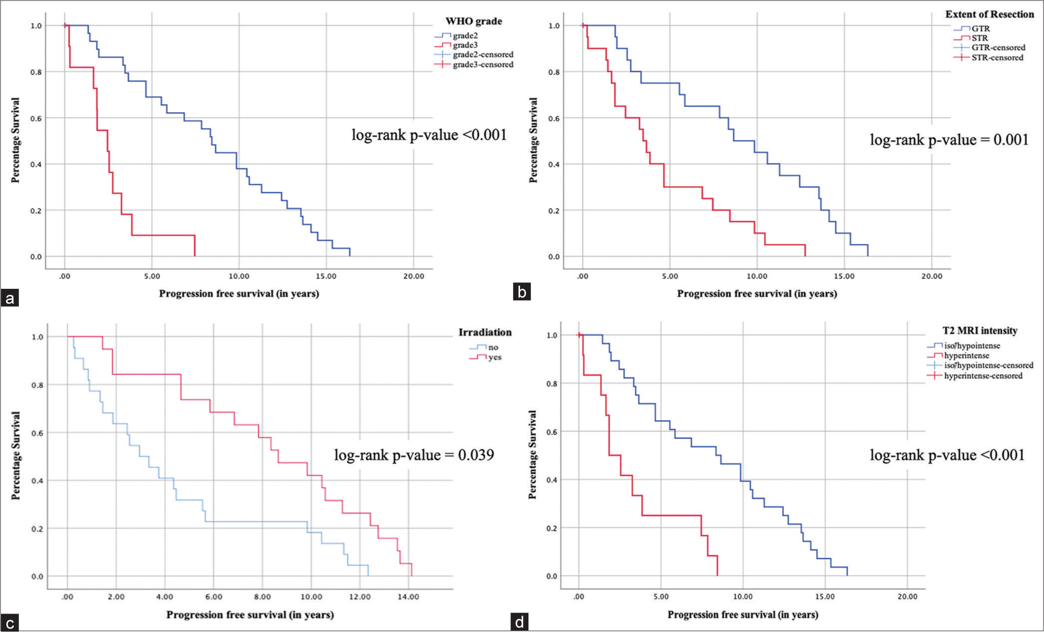 Selected Kaplan–Meier plots of progression-free survival (PFS) for high-grade meningiomas. In cumulative analyses, (a) median PFS was 8.43 years (95% confidence interval [CI] = 7.0–9.85 years) with grade 2 meningiomas and 2.45 years (95% CI = 1.69–3.2 years) with grade 3 meningiomas, (b) the median PFS was 8.65 years (95% CI = 5.38–11.9 years) after gross total resection and 3.46 years (95% CI = 2.58–4.33 years) after subtotal resection, (c) the median PFS after surgery and adjuvant irradiation was longer, 8.65 years (95% CI = 5.8–11.5 years) than after surgery alone 3.34 years (95% CI = 2.27–4.4 years), and (d) the median PFS for iso/hypointense lesion was 8.35 years (95% CI = 4.21–12.48 years) while that of hyperintense lesion was 1.84 years (95% CI = 0.83–2.84 years). WHO: World Health Organization, GTR: Gross total resection, STR: Subtotal resection.