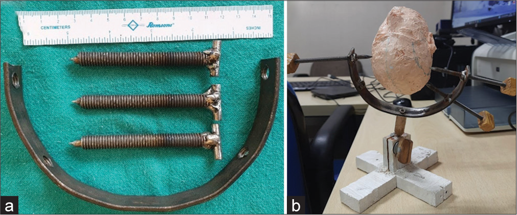 (a) Simple iron metal model of Sugita type head frame arc with three functional pins, which may be used for training for head frame application. (b) Metal model of Sugita head frame with functional pin application system holding a head model made by three-dimensional (3D) pen using acrylonitrile butadiene styrene filament used in 3D printers.