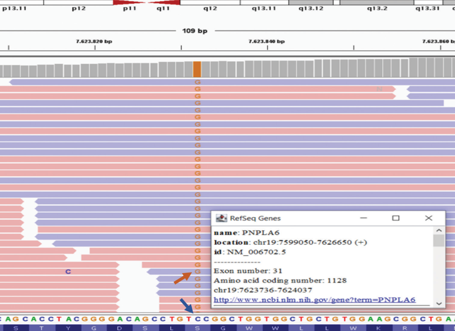 The next-generation sequencing profile of the PNPLA6 (NM006702.5) gene for the proband case is depicted. In this particular case, we identified a homozygous missense point mutation, c.3380C>G (p.Ser1127Cys), in the 31st exon of PNPLA6. The blue line corresponds to the wild-type C base (normal), whereas the red arrow indicates the G base (homozygously mutated) at the transversion point, occurring at codon 376 of exon 31 for the PNPLA6 gene situated at the chromosome 19p13.2 locus.