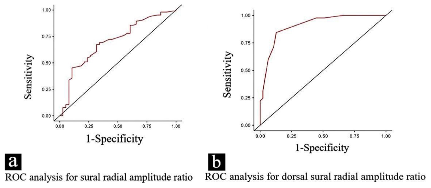 (a and b) The receiver operating characteristic curve shows the diagnostic performance of the sural/radial amplitude ratio and dorsal sural/radial amplitude ratio in distinguishing between neuropathic and non-neuropathic groups. The curves illustrate the trade-offs between sensitivity and 1-specificity at different threshold points for both ratios. ROC: Receiver operating characteristic curve.